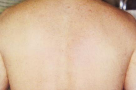 Before and After