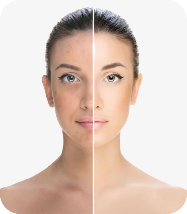 Laser Hair Removal - Body Laser & Skin Clinic